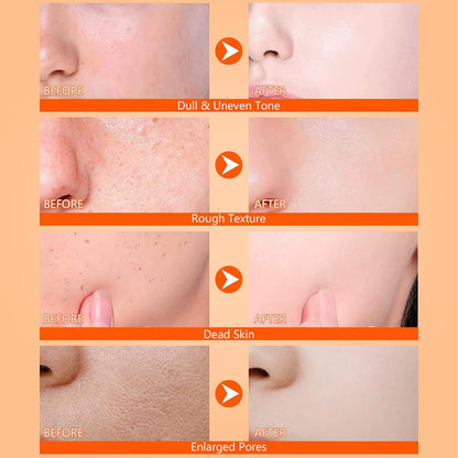 Revitalize Your Skin with Body Keratin Care Kojic Acid & Turmeric Exfoliating Spray - Nourishing Peeling Solution for All Skin Types